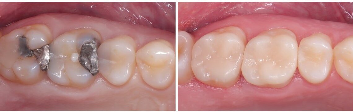 Dentysta Stomatolog Warszawa Wawer Miedzeszyn